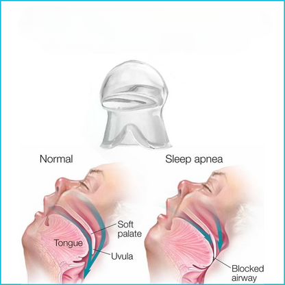 HarmonieLab™ - Night Comfort Mouthpiece