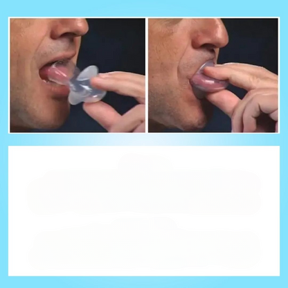 HarmonieLab™ - Night Comfort Mouthpiece