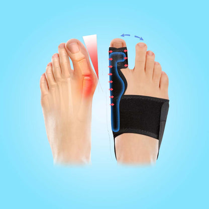 HarmonieLab™️ - Bunion Corrector