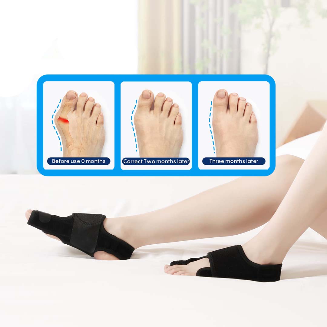 HarmonieLab™️ - Bunion Corrector